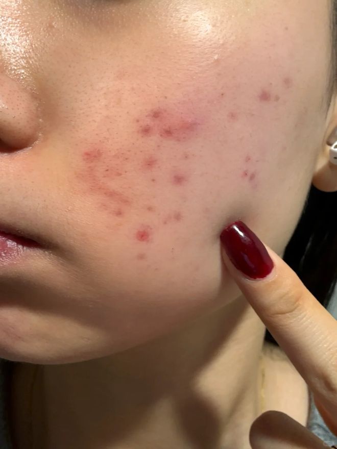 久没换了？这种毛巾建议马上换掉澳门新葡京